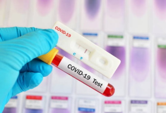 Turkey’s first 2 deaths as coronavirus cases jump to 191 Turkey’s first 2 deaths as coronavirus cases jump to 191